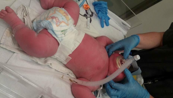 Un Bebe Nacio Con Un Peso De Mas De 7 Kilos Y Midio 57 Centimetros 10 05 17 El Pais Uruguay