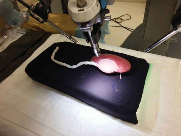 Réplica de un riñón hecha por Lazarus 3D. Foto: Efe.