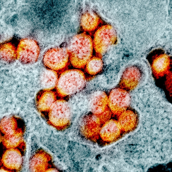 Micrografía electrónica de transmisión de partículas del virus SARS-CoV-2, aislada de un paciente. Foto: NIAID