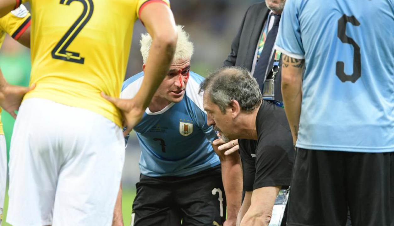 Uruguay debutÃ³ en la Copa AmÃ©rica ante Ecuador. Foto: Gerardo PÃ©rez / El PaÃ­s