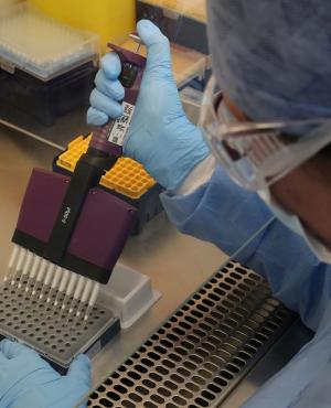 Test para identificar si se tiene coronavirus COVID-19. Foto: AFP - Archivo